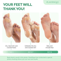 PLANTIFIQUE Plantifique Foot Peel Mask – 2 Pairs Exfoliating & Dermatologically Tested Foot Treatment, Removes Dead Skin & Repairs Heels for Soft Feet – Peach Scent, Gift for Women & Men
