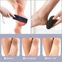 Natural Pumice Stones for Feet, Premium Exfoliator & Foot File,Foot File Callus Remover Foot Cracked Heels,Dead Skin,Hard Skin (Black)