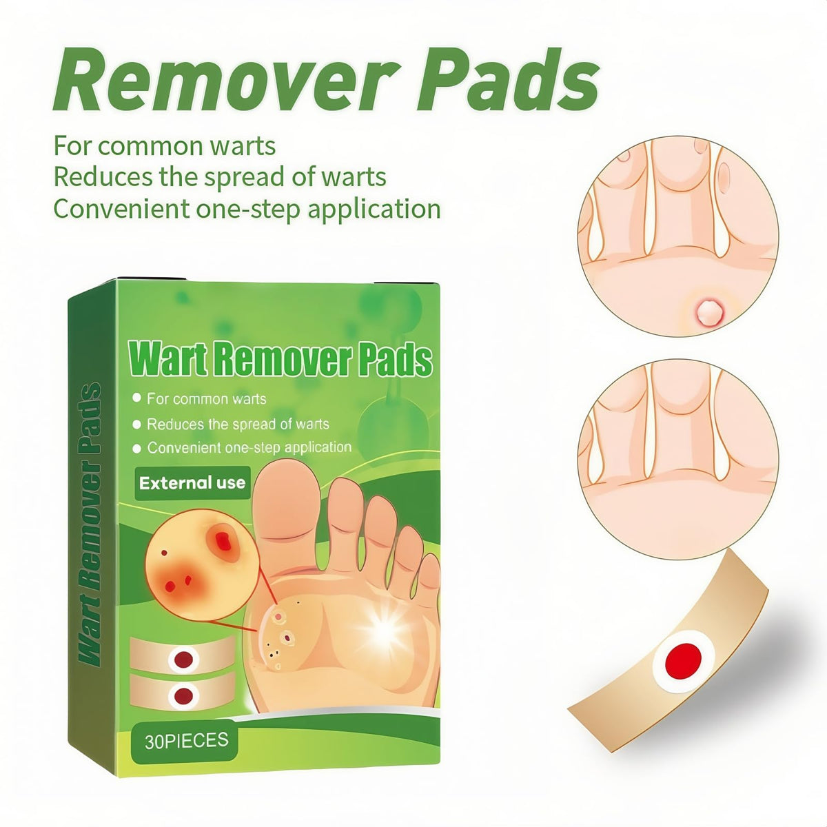 ShengQiu 30pcs Wart Remover,Verruca Treatment,Wart Remover for Hands,Plantar Wart R/emover for Feet,Effective Deep Verruca R/emoval Pads Patches for Adults