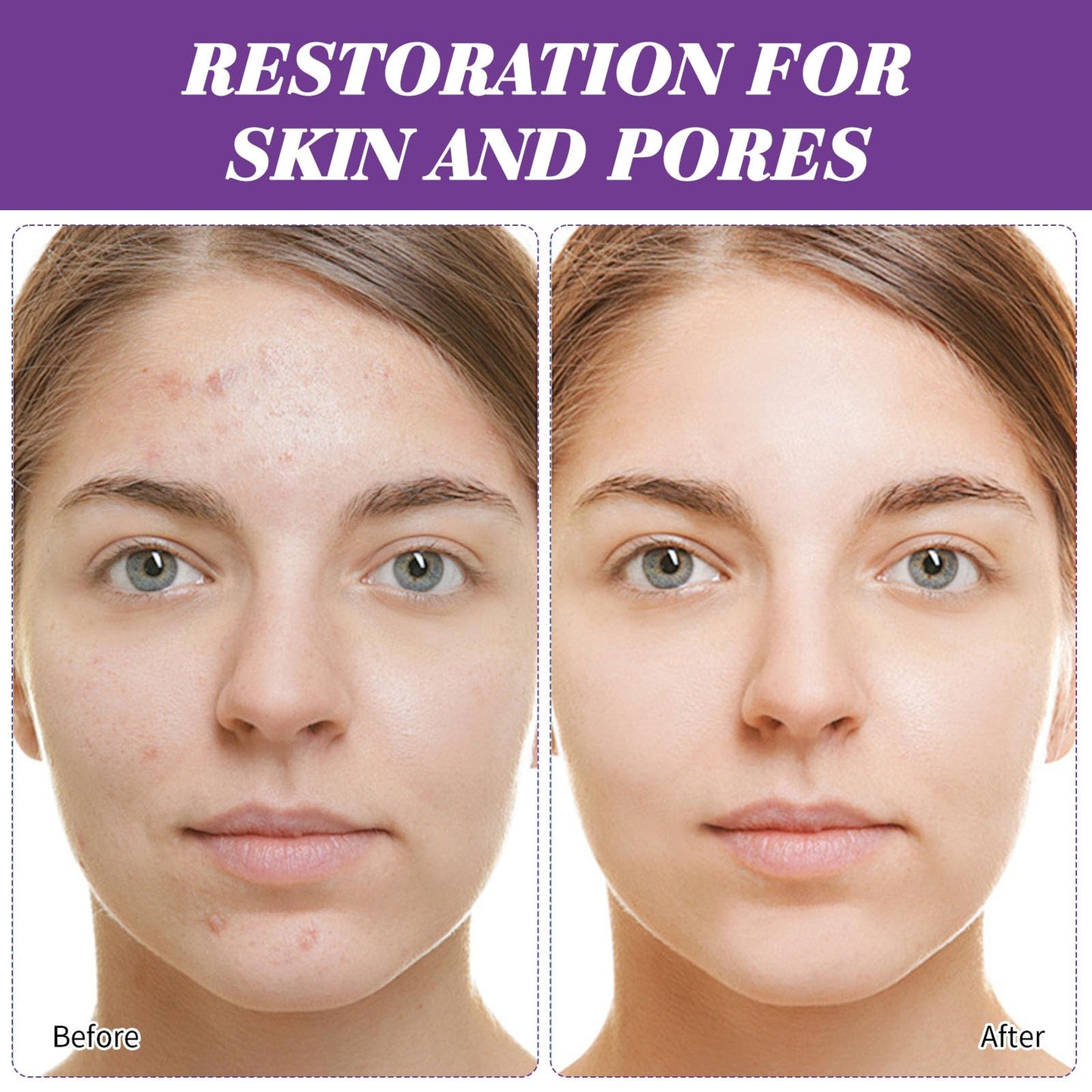 Azelaic Acid Cream,Azelaic Acid Face Cream,Azelaic Acid Serum,Azelaic Acid 12% Facial Serum,Facial Serum Cream,Niacinamide & Vitamin C Face Cream,For All Skin Types (20g)