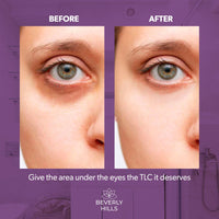 BEVERLY HILLS Beverly Hills - Eye Cream for Dark Circles and Puffy Eyes - Anti-Aging Eye Care - Reduces Dark Circles & Puffiness - 30ml