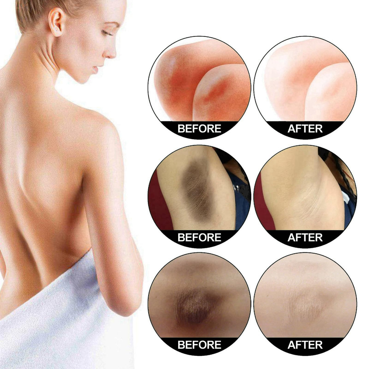 AINxtolm 2PCS Skin Bleaching Cream,Skin Lightening Cream,Snow Bleach Cream,Underarm Whitening Cream for Private Part,Whitening Cream for Body,Inner Thigh Lightening Cream,Under Arm Whitener Even Skin Tone