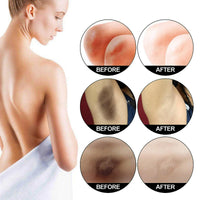 AINxtolm 2PCS Skin Bleaching Cream,Skin Lightening Cream,Snow Bleach Cream,Underarm Whitening Cream for Private Part,Whitening Cream for Body,Inner Thigh Lightening Cream,Under Arm Whitener Even Skin Tone