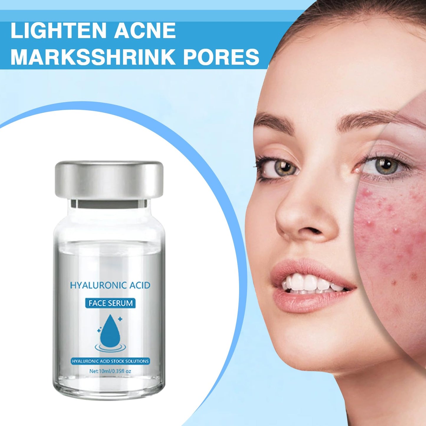 Ninnyi Micro Infusion Facial System With Serum Beauty Lips Kit for Repair Skin Deep Nourishment All Skin Types(5 PCS)