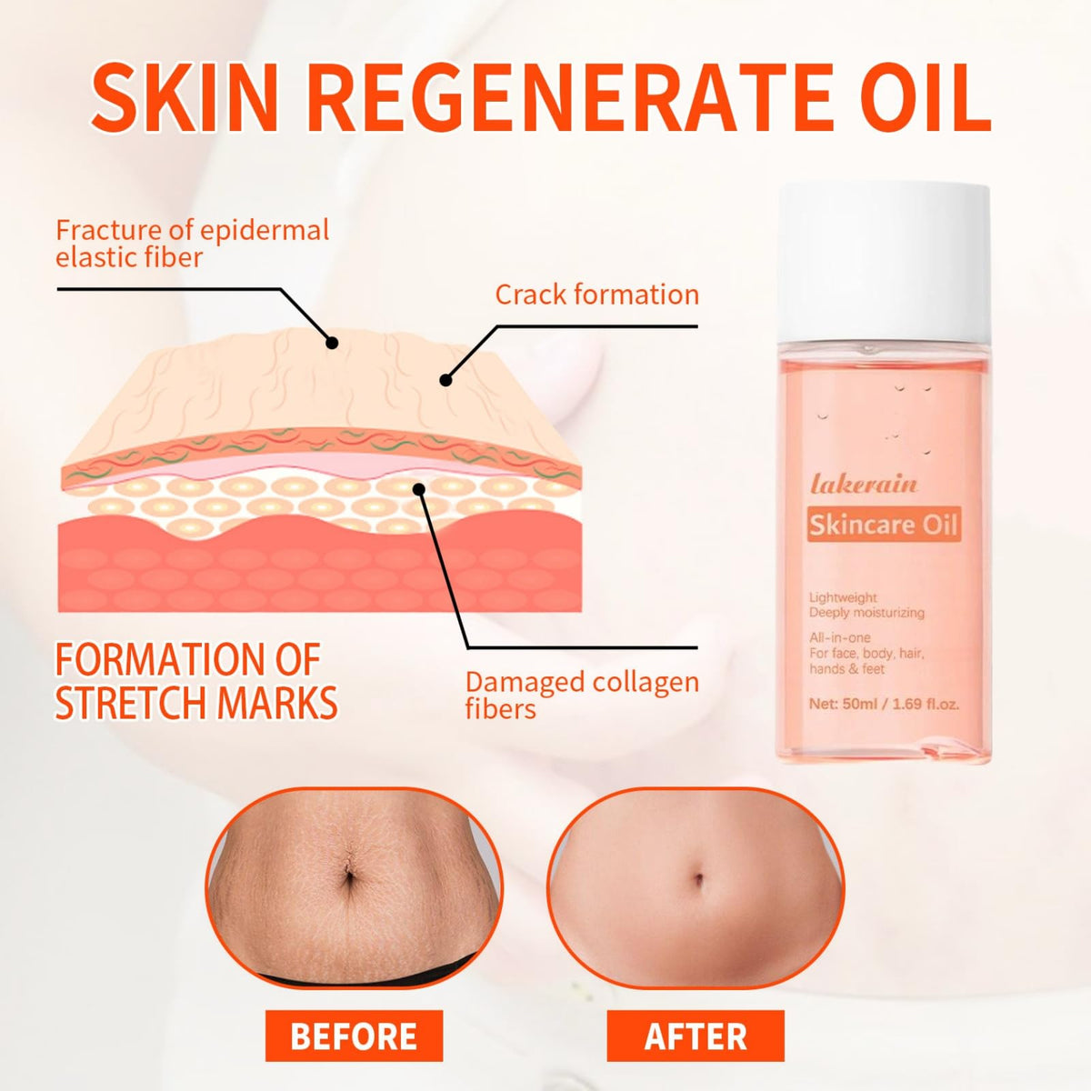 LaluluTek Stretch Mark Treatment Oil for Women - Optimal Formula for Removal of Stretch Marks, Scars, Firming & Lifting Body Care, 50ml