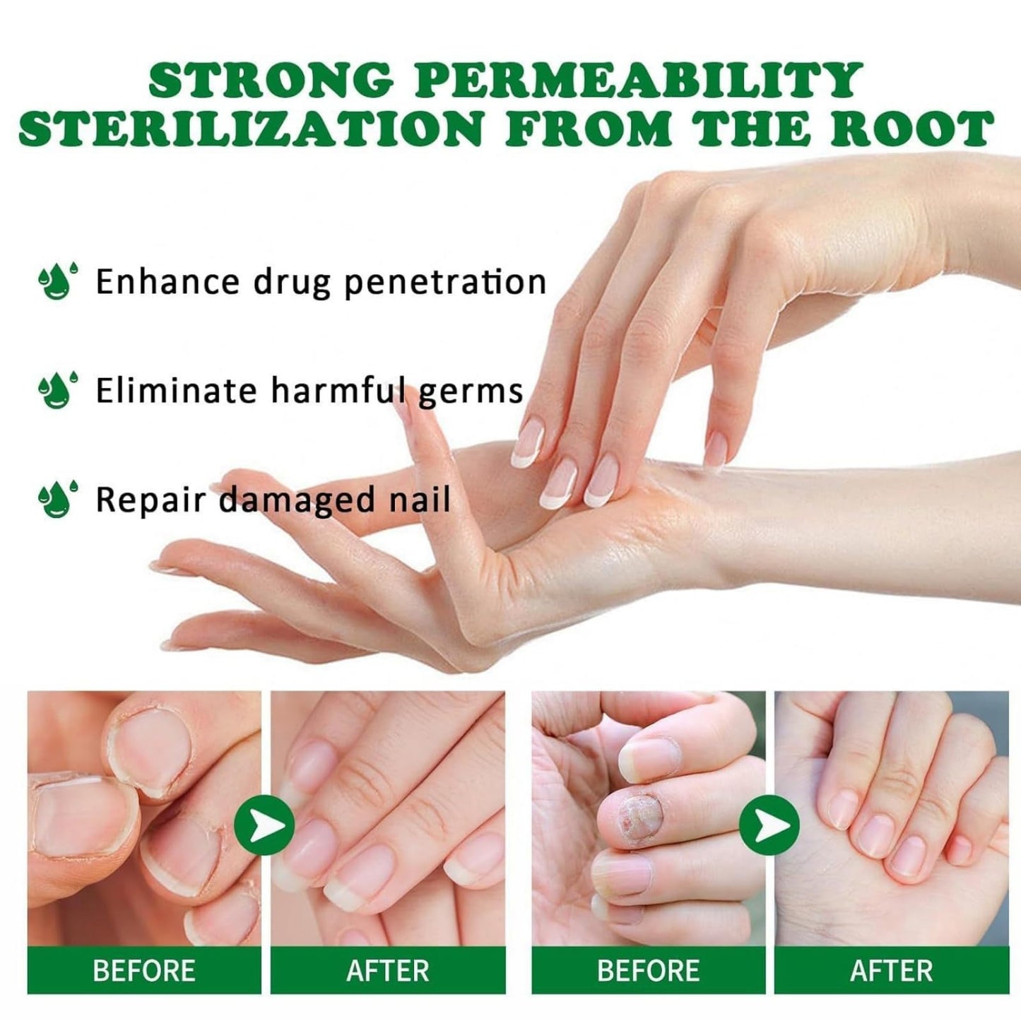 2PCS Nail Care Pen & Serum,Nail Revive Pen,Fungel Nail Treatmant Pe/n,Toena/il Fungas Treatmant P/en,To/enails Repair Pe/n,Nai/l Repair Essence for Toena/il and Fingernails,Fungel N/ail trea/tmant