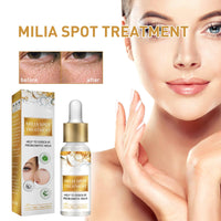 GNAUMORE Milia Spot Serum for Face,Milia Treatment under Eye,Eye Serum for Dark Circles and Puffy Eyes,Fat Granule Clearing Skin Serums,Even and Radiant Skin Generic,30ml