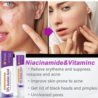 Night Cream Face Moisturiser, Azelaic Acid 12% Facial Serum Cream,Dark Spot Serum Cream for Face,Skincare with Niacinamide & Vitamin C,Beauty Products for Rosacea,Acne,Balance Excess Sebum