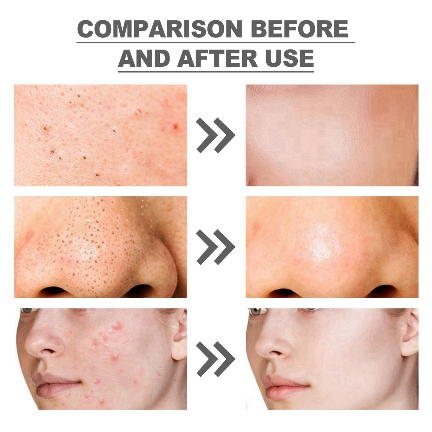 BigyQiu Azelaic Acid 12% Facial Serum Cream,Azelaic Acid Cream with Niacinamide Vitamin C,Brightening Face Skin Care Treatment for All Skin Types,Repair Dark Spots Skincare for Fresher and Smoother Skin