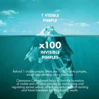 Avene Avène Cleanance Comedomed Anti-blemish Concentrate Moisturiser for Blemish-prone Skin 30ml