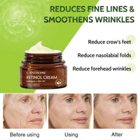 Trendyfave Retinol Face Cream, Night Cream for Women Anti Aging, Cream with Hyaluronic Acid Vitamin C Cream Face Moisturizer, Wrinkle Repair Collagen Face Cream, Softer, Smoother, 50g