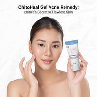 ChitoTech ChitoHeal Gel Acne Remedy- 20g Natural Acne Treatment for Pimples, Acne Scars, Alcohol & Corticosteroid Free, N-acetyl-D-Glucosamine for Clear Skin