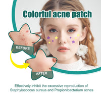 LIDOUK 12mm and 8mm spot patches, acne patches, star shaped, water-based gel patches for acne, blemishes, cyanosis, and facial acne patches (112 patches)