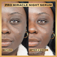 Revolution Beauty London Revolution Pro, Miracle Night Rescue Serum Advanced Complex, Overnight Face Serum, Smooths and Plumps Skin, 30 ml