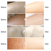 Grospe Skin Exfoliating Repair Cream, Chicken Skin Care Cream, Strawberry Legs Treatment Body Cream, Hydrating Moisturising Refreshing Skin Fragrance Repair Body Lotion 50g