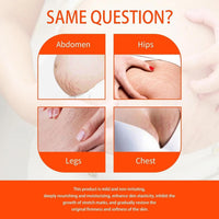 Natrcollor 2 PCS Stretch-Mark Scar Treatment Oil, Collagen Boosting Firming & Lifting Skincare for Women. Helps Remove Stretch Marks & Scars, 250 ml