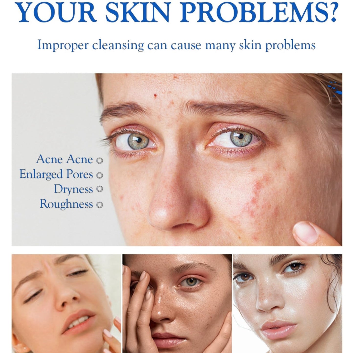 Acne Foaming Wash,Mild Daily Facial Cleanser for Deep Pore Cleansing,Acne Foa/m Wash,Gentle Daily Cleans/ing Foam,Clea/nsing Fo/am for Women,Facial Wash Women to Soothe Redness,Exfoliating Face Wash