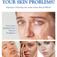 Acne Foaming Wash,Mild Daily Facial Cleanser for Deep Pore Cleansing,Acne Foa/m Wash,Gentle Daily Cleans/ing Foam,Clea/nsing Fo/am for Women,Facial Wash Women to Soothe Redness,Exfoliating Face Wash