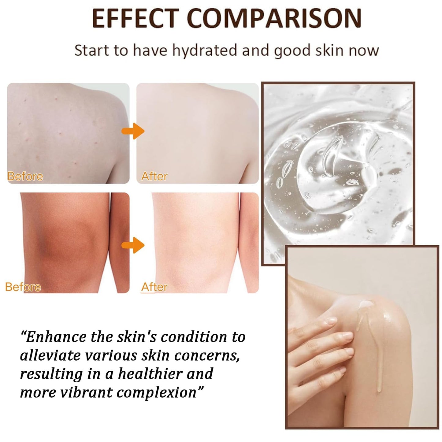 Lomeya Vitamin C Facial Oil Gel with Essential Oils for Skin - Body Oil for Women - Massage Oil for Dry Skin - Face & Body - Easy Absorption - 200ML (Orange)