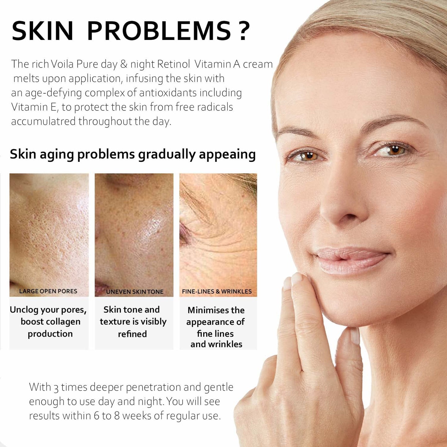 Voila Pure - RETINOL CREAM - Moisturizer - For Face & Neck - 2.5% Slow Release Retinol - Infused With Hyaluronic Acid & Vitamin E - Use Day & Night For Best Anti-Ageing & Acne Results - 1.7fl Oz