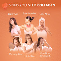 supplmnt. Marine Collagen Gummies - Hydrolysed Collagen Peptides with Biotin, Hyaluronic Acid & Vitamin C - Collagen Supplements for Women and Men - 120 Gummies. Collagen for Skin, Hair & Nails 2 Months Supply