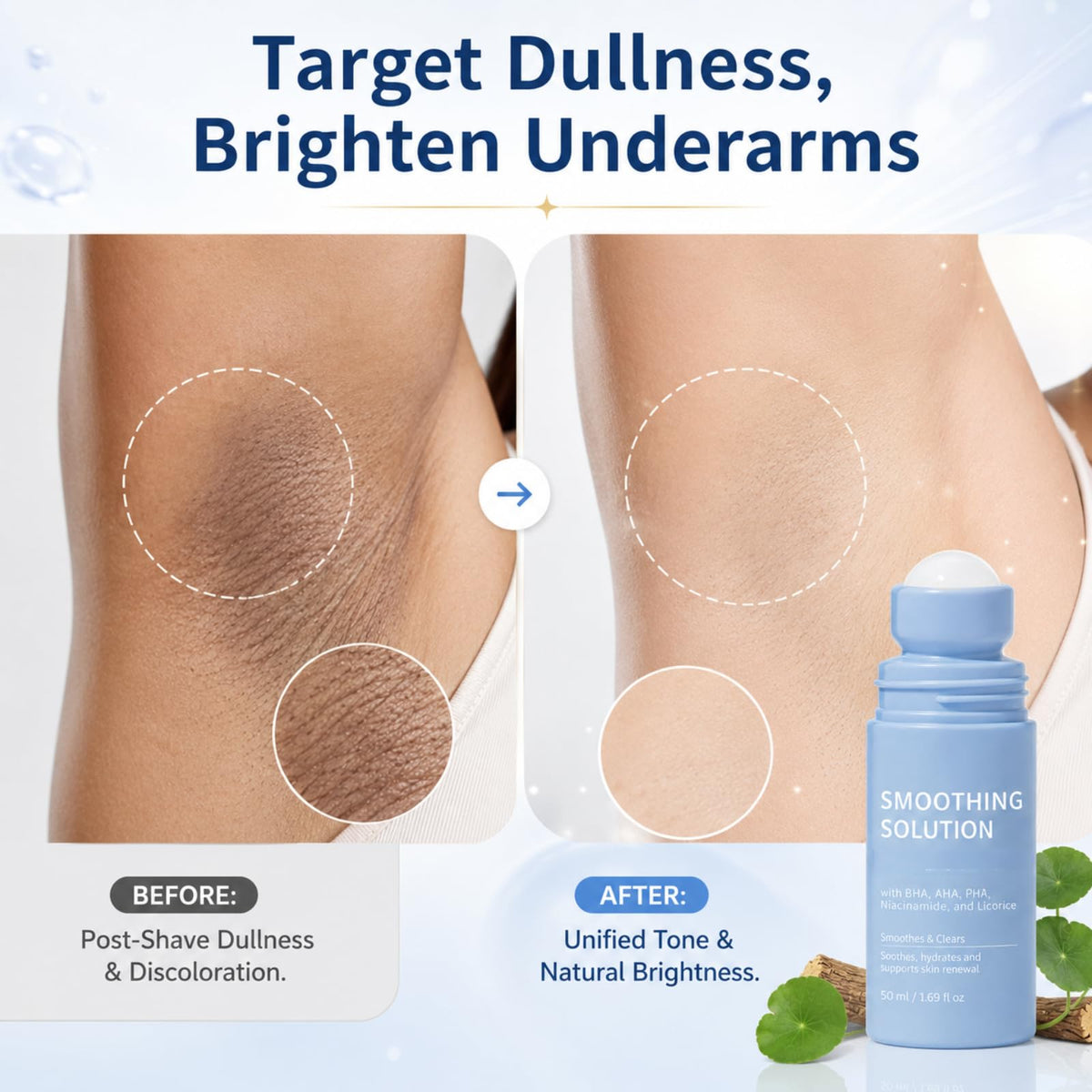 IZBEAUVO 2pcs Razor Bump Smoothing Solution Ingrown Hair Reduction with BHA AHA - High Roller Ingrown Tonic for Underarms Abdomen - Ingrown Hair Serum for Men & Women - Roller Ball Applicator for Tend Skin