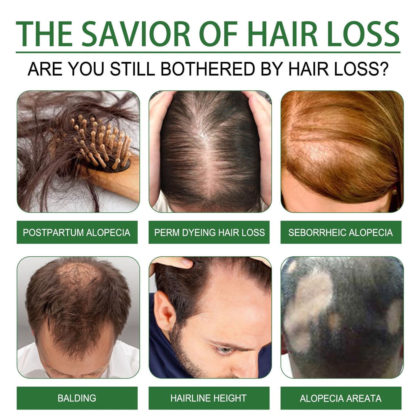 AmiCera Rosemary Oil for Hair Growth, Organic Pure Rosemary Essential Oil, with Derma Roller for Hair, Hair Strengthening for Men Women, Scalp Massage & Nourish, Eyebrow Eyelash Growth Oils, 60ml, 2 Brushes