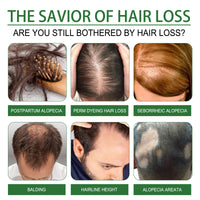 AmiCera Rosemary Oil for Hair Growth, Organic Pure Rosemary Essential Oil, with Derma Roller for Hair, Hair Strengthening for Men Women, Scalp Massage & Nourish, Eyebrow Eyelash Growth Oils, 60ml, 2 Brushes