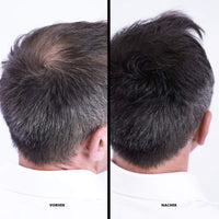 Super Million Hair hair building fibres 25 g