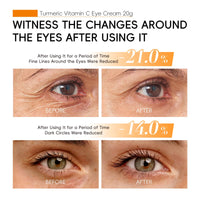 Trendyfave Turmeric Vitamin C Eye Cream Anti Aging, Turmeric Eye Cream For Dark Circles And Puffy Eyes, For Even_Skin Tone, Smooth Fine Lines - 2PCS