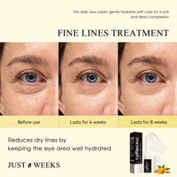 TBeautfave Turmeric Retinol Eye Stick, Retinol Eye Cream for Dark Circles and Puffy Eyes, Anti Wrinkle Eye Cream Anti Aging, Turmeric Multi Balm Stick for Eye/Face/Neck, Visibly Reduces Fine Lines, 5g