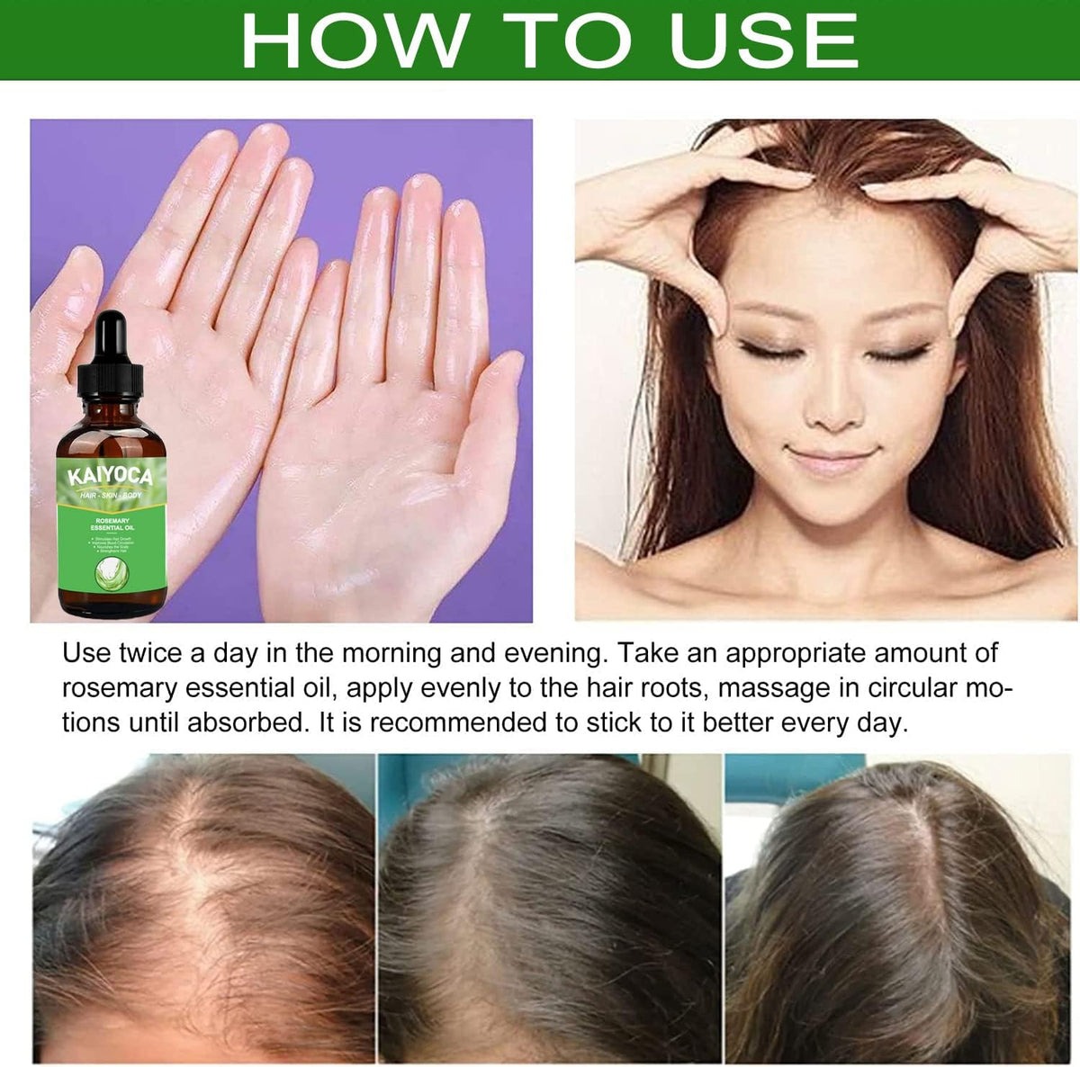 KAIYOCA 2 Packs Pure Natural Rosemary Essential Oils, Hair Growth Scalp Oil for Dry Damaged Hair, Hair Loss Treatment, Nourishes The Scalp, Rid of Itchy & Dry Scalp
