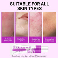 Bettinay Rosacea Cream for Face, 12% Azelaic Acid Cream, Gentle and Moisturizing for all Skin Pigmentation Redness