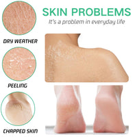 ISBEAUSOLS 40% Urea Foot Cream - Ultra Moisturizing Urea Foot Cream Plus Deeply Hydrating - 2% Salicylic Acid Urea Cream - Foot Cream for Cracked Heels and Dry Skin - Nourish Foot Moisturiser 150g