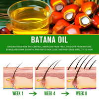 QUIWEN Batana Oil for Hair Growth & Skin Care, 100% Pure & Natural Batana Oil, Prevents Hair Loss, Repairs Damaged Hair & Skin, eliminates Split Ends & Increases Shine