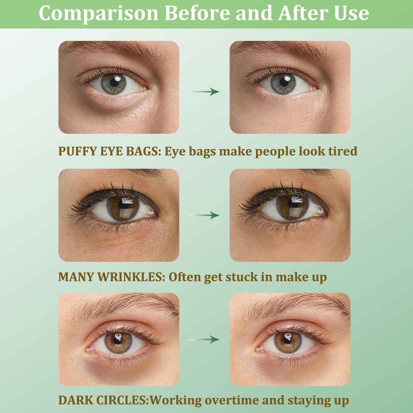 CGBOOM Under Eye Patches, Collagen Under Eye Mask, Dark Circles Under Eye Treatment, Puffy Eyes Bags Under Eyes Removal, Anti-Aging, Reduce Wrinkle, Skincare, Hydrating - 30 Pairs (Avocado)