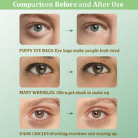 CGBOOM Under Eye Patches, Collagen Under Eye Mask, Dark Circles Under Eye Treatment, Puffy Eyes Bags Under Eyes Removal, Anti-Aging, Reduce Wrinkle, Skincare, Hydrating - 30 Pairs (Avocado)
