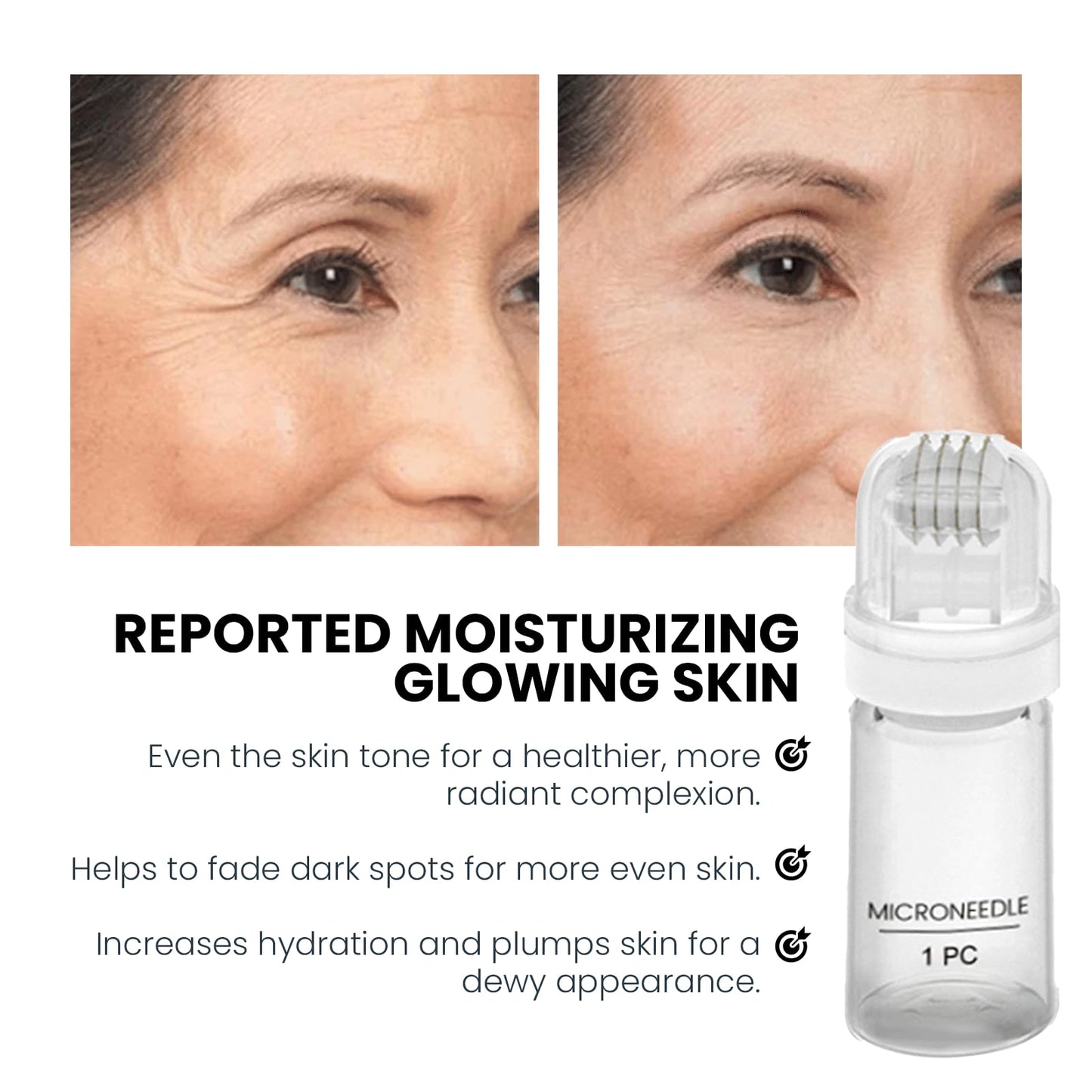 BloomBelle Micro Infusion Facial System, Hyaluronic Acid Microneedling Serum Rejuvenates, Anti-Aging Serum Set, Reduces Wrinkles, Micro Infusion System Enhances Elasticity, Deep Hydration for All Skins