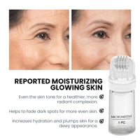BloomBelle Micro Infusion Facial System, Hyaluronic Acid Microneedling Serum Rejuvenates, Anti-Aging Serum Set, Reduces Wrinkles, Micro Infusion System Enhances Elasticity, Deep Hydration for All Skins