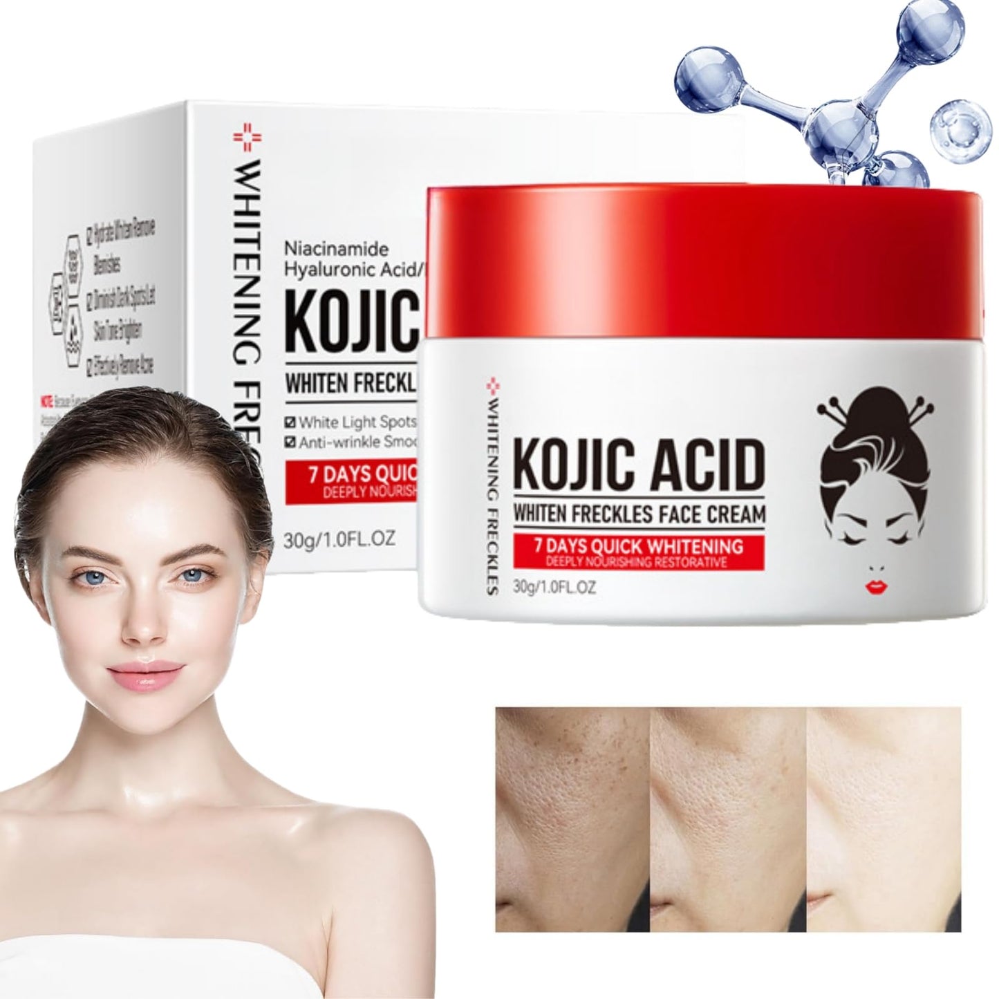 Kojic Acid Cream,Skin Lightening Cream for Anti Aging,Dark Spot Correcting Glow Serum,Dark Spot Corrector,Dark Spot Remover for Face,Spot Cream,Face Moisturizer for Women,Dark Spot Cream,Spot Gel