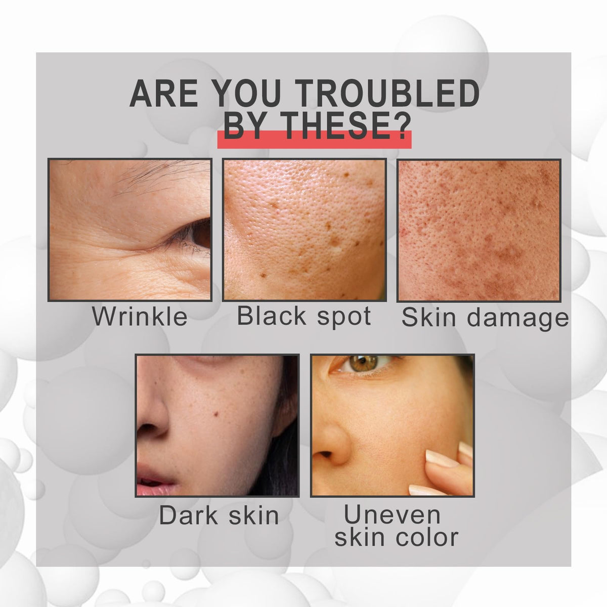 Siyinzu Bee Venom Wrinkle Removal Cream,Bee Venom Anti Aging Face Cream,Bee Venom Cream,Skin Tightening Creams for Face,Firming Face Serum for Women,Bee Venom Skin Treatment Serum,Face Cream for Mature