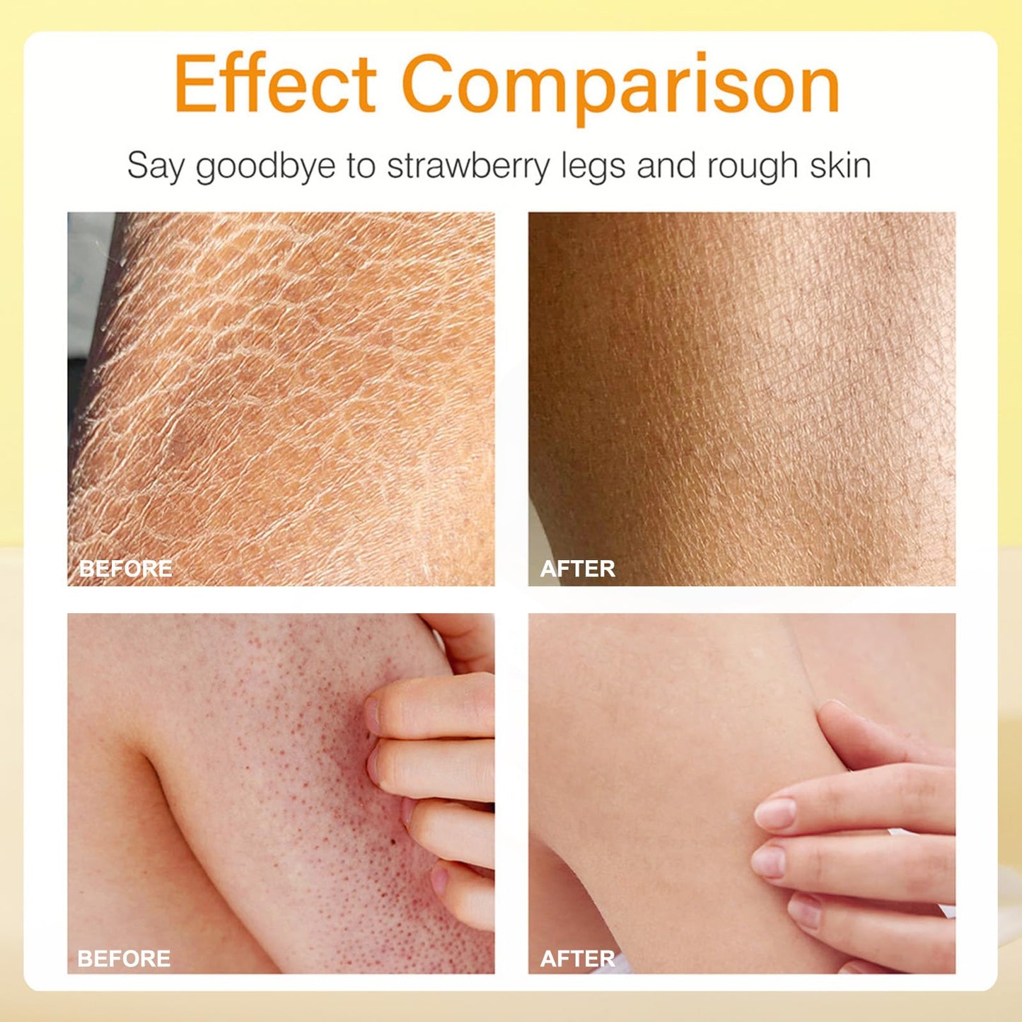 Pothenika Strawberry Legs Treatment Cream, Keratosis Pilaris Treatment, Anti Winkle Smoothing Face Body Moisturiser, Deep Nourishment Skin Exfoliating Repair Cream Fades Strawberry Skin,120g