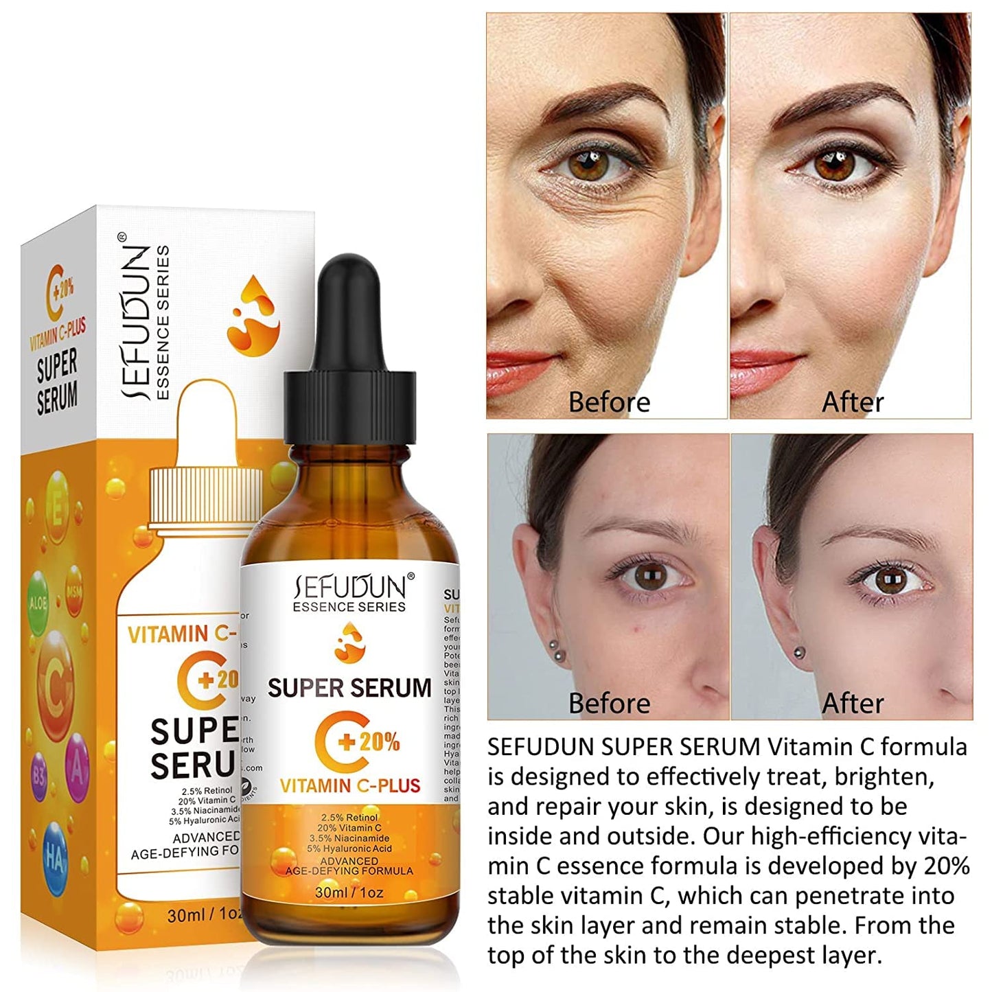 Premium 20% Vitamin C Serum for Face with Hyaluronic Acid (30 ml), Anti Aging & Wrinkle Facial Serum for Women & Men, Antioxidant, Fades Dark Spot, Boost Skin Collagen, Hydrate & Brighten