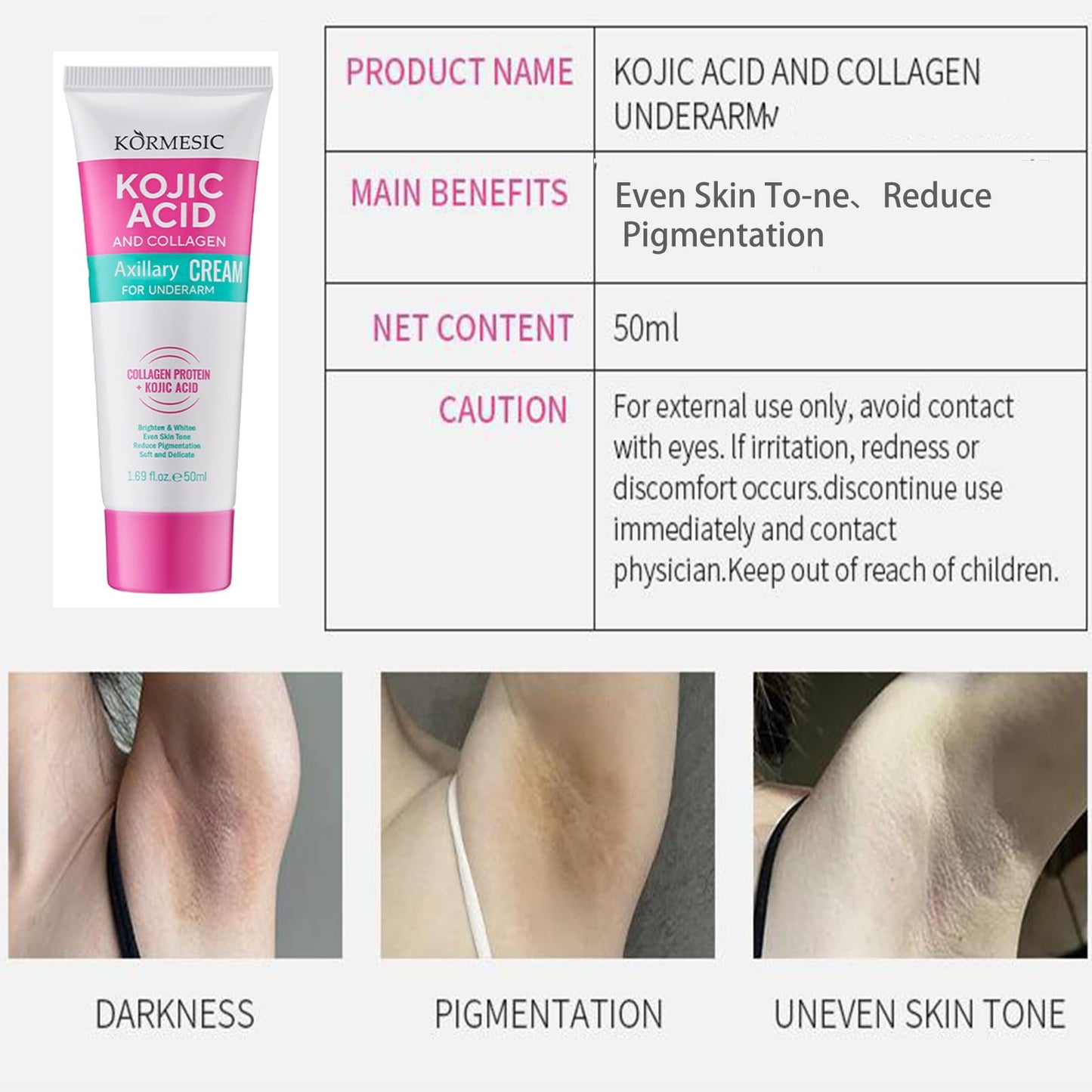 Korean Skin Care, Kojic Acid Skin Cream, Skin Bleaching Cream for Armpit, Knees And Elbows, Elbows, Inner Thigh, Bikini Areas, Underarm Whitening Products Quickly Absorb & Reduce Odor, Smoothing