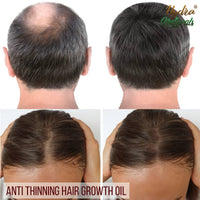 Hydra Naturals 100% Pure - Cold Pressed, Premium Quality, Organic Castor Oil 50ml - Promotes Hair, Eyebrow and Eyelash Growth - Diminishes Wrinkles and Signs of Aging - Hydrates and Nourishes Skin