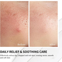 Vitamin B5 Repair Face Serum Cream,Skin Barrier Repair Cream,B5 Cre-am,Hydrating Cre-am,Skin Firming Butter,Restore Luster,Restore The Damaged Sk-In,Face Moisturizer For Women &Men And Sensitive