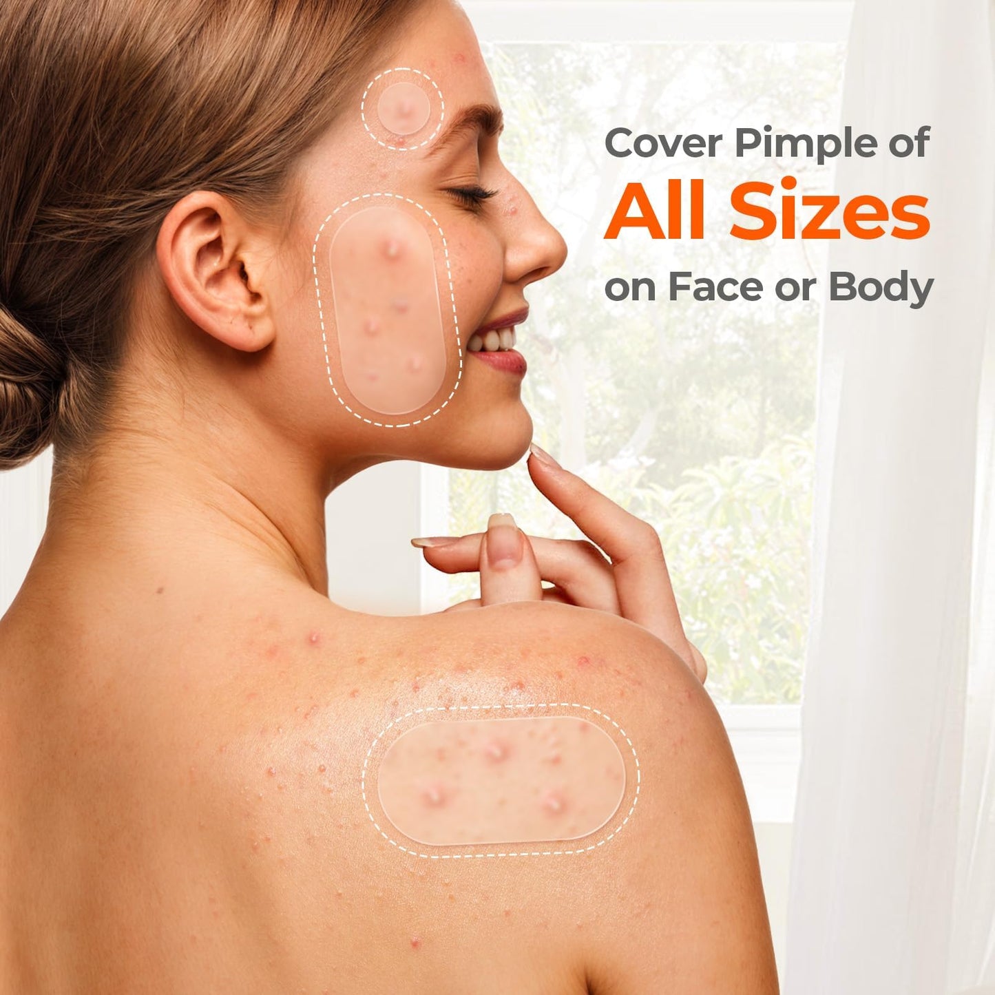 TKTK 443 Count Pimple Patches for Face, Hydrocolloid Spot Stickers, 5 Sizes