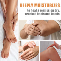 HERBINSOLS Honey Foot Cream - 2pcs Foot Cream For Very Dry Feet - Heel Cream For Deep Cracked Skin - Deep Hydration Foot Moisturiser - Intensive Moisturizing Daily Hands & Feet Skin Care Stick