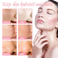 2pcs Watermelon Face Cream, Watermelon Skin Care, Watermelon Essence Face Cream, Lighten Acne Spots, Moisturising & Whitening Face Cream, 2pcs*50ml