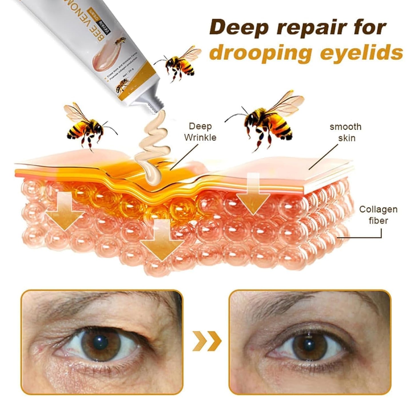 ALLILUYAA 2PCS Furzero Bee Venom Anti-Wrinkle Cream, Furzero Bee Venom Wrinkle Removal Cream, Anti-Wrinkle Moisturiser for Face and Neck, Bee Venom Anti-Wrinkle Cream for All Skin Types